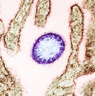 Nipah virus